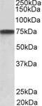 Cyclin D1 Binding Protein 1 antibody, 42-984, ProSci, Western Blot image 