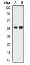 General Transcription Factor IIH Subunit 4 antibody, LS-C668056, Lifespan Biosciences, Western Blot image 