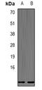 Defensin Beta 132 antibody, abx141583, Abbexa, Western Blot image 