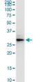 VAMP Associated Protein A antibody, H00009218-M01, Novus Biologicals, Western Blot image 