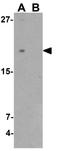 Transmembrane Protein 107 antibody, GTX32119, GeneTex, Western Blot image 