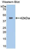 Keratin 16 antibody, LS-C301750, Lifespan Biosciences, Western Blot image 