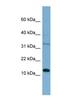 Pleckstrin Homology Like Domain Family A Member 2 antibody, NBP1-59088, Novus Biologicals, Western Blot image 