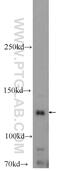 Retinal guanylyl cyclase 2 antibody, 25252-1-AP, Proteintech Group, Western Blot image 