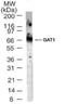 Solute Carrier Family 6 Member 1 antibody, NBP2-25078, Novus Biologicals, Western Blot image 