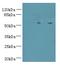 T-Complex-Associated-Testis-Expressed 1 antibody, A61282-100, Epigentek, Western Blot image 