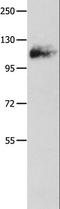 Amphiphysin antibody, LS-C403811, Lifespan Biosciences, Western Blot image 