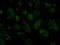 Intraflagellar Transport 57 antibody, GTX84311, GeneTex, Immunofluorescence image 