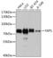 YAP1 antibody, GTX35195, GeneTex, Western Blot image 