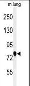 Semaphorin 3C antibody, LS-C168951, Lifespan Biosciences, Western Blot image 