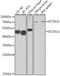 Inducible T Cell Costimulator Ligand antibody, A01965-1, Boster Biological Technology, Western Blot image 