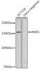 Anoctamin 1 antibody, GTX64457, GeneTex, Western Blot image 