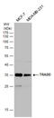 TNFRSF1A Associated Via Death Domain antibody, GTX132467, GeneTex, Western Blot image 