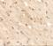 Transmembrane Protein 59 Like antibody, A15285, Boster Biological Technology, Immunohistochemistry paraffin image 
