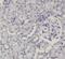Protein Phosphatase 2 Scaffold Subunit Aalpha antibody, FNab06714, FineTest, Immunohistochemistry frozen image 