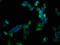 ADAM Metallopeptidase Domain 10 antibody, LS-C375148, Lifespan Biosciences, Immunofluorescence image 