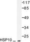 Heat Shock Protein Family E (Hsp10) Member 1 antibody, LS-C176068, Lifespan Biosciences, Western Blot image 