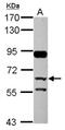 Complement factor H-related protein 5 antibody, NBP2-14912, Novus Biologicals, Western Blot image 