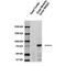 Sodium Channel Epithelial 1 Gamma Subunit antibody, PA5-77797, Invitrogen Antibodies, Western Blot image 