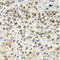 MutS Homolog 6 antibody, LS-C331182, Lifespan Biosciences, Immunohistochemistry paraffin image 