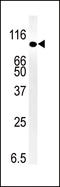 SMAD Specific E3 Ubiquitin Protein Ligase 1 antibody, LS-B3450, Lifespan Biosciences, Western Blot image 