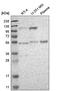 DNA Polymerase Kappa antibody, HPA012035, Atlas Antibodies, Western Blot image 