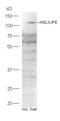Lipase E, Hormone Sensitive Type antibody, orb10843, Biorbyt, Western Blot image 