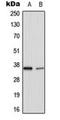 TNF Alpha Induced Protein 1 antibody, orb224029, Biorbyt, Western Blot image 