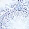 MutS Homolog 6 antibody, GTX65844, GeneTex, Immunohistochemistry paraffin image 