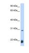 ACHAETE antibody, NBP1-79448, Novus Biologicals, Western Blot image 