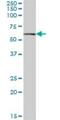 Amylase Alpha 1C (Salivary) antibody, H00000277-B01P, Novus Biologicals, Western Blot image 