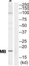 Myoglobin antibody, abx014611, Abbexa, Western Blot image 