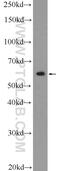 Zinc Finger And BTB Domain Containing 22 antibody, 25633-1-AP, Proteintech Group, Western Blot image 