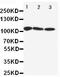 ATPase Sarcoplasmic/Endoplasmic Reticulum Ca2+ Transporting 1 antibody, PA1719, Boster Biological Technology, Western Blot image 