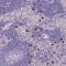 Tryptase Delta 1 antibody, NBP2-46776, Novus Biologicals, Immunohistochemistry paraffin image 
