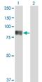 T Cell Lymphoma Invasion And Metastasis 2 antibody, H00026230-M01, Novus Biologicals, Western Blot image 