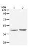Alanine--Glyoxylate And Serine--Pyruvate Aminotransferase antibody, orb107590, Biorbyt, Western Blot image 