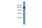 Basonuclin 2 antibody, GTX44668, GeneTex, Western Blot image 