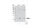 Suppressor Of Cytokine Signaling 1 antibody, 3950S, Cell Signaling Technology, Western Blot image 