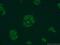DEAD box protein HAGE antibody, 17591-1-AP, Proteintech Group, Immunofluorescence image 