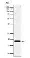 ER Membrane Protein Complex Subunit 4 antibody, M13212, Boster Biological Technology, Western Blot image 