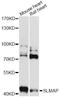 Sarcolemma Associated Protein antibody, LS-C749371, Lifespan Biosciences, Western Blot image 