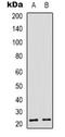 Recoverin antibody, LS-C368829, Lifespan Biosciences, Western Blot image 