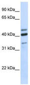 Hyaluronidase 1 antibody, TA339812, Origene, Western Blot image 