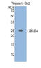 Osteoclast Stimulating Factor 1 antibody, LS-C295729, Lifespan Biosciences, Western Blot image 