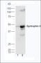 Syntrophin Beta 2 antibody, orb158550, Biorbyt, Western Blot image 