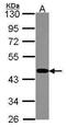 Proteasome 26S Subunit, ATPase 6 antibody, GTX114677, GeneTex, Western Blot image 