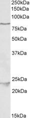 TANK Binding Kinase 1 antibody, LS-B11263, Lifespan Biosciences, Western Blot image 