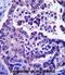 ADP Ribosylation Factor Like GTPase 8A antibody, abx027401, Abbexa, Immunohistochemistry paraffin image 