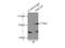 ABCD1 antibody, 11159-1-AP, Proteintech Group, Immunoprecipitation image 